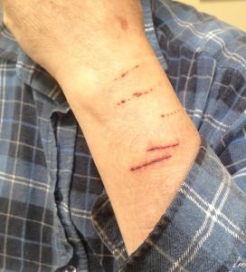 2015-12-11 - Rabbit shredder